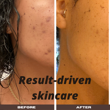 Load image into Gallery viewer, Pulsating Clay Turmeric Mask (4oz)